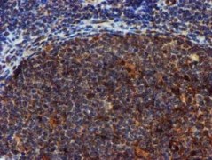 ab119402 at 1/150 dilution staining SPR in paraffin-embedded Human tonsil tissue by Immunohistochemistry.