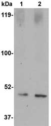 Lane 1 : Anti-SPRED1 antibody (ab77079) at 1 µg/mlLane 2 : Anti-SPRED1 antibody (ab77079) at 2 µg/mlLane 1 : Human brain tissue lysateLane 2 : Human brain tissue lysateLysates/proteins at 15 µg per lane.