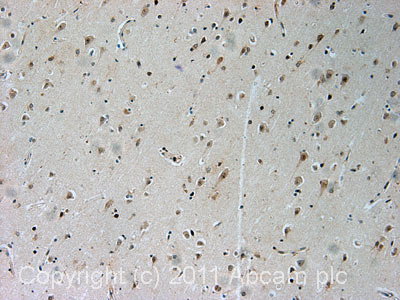 IHC image of ab77079 staining in human cerebral cortex formalin fixed paraffin embedded tissue section, performed on a Leica BondTM system using the standard protocol F. The section was pre-treated using heat mediated antigen retrieval with sodium citrate buffer (pH6, epitope retrieval solution 1) for 20 mins. The section was then incubated with ab77079, 1µg/ml, for 15 mins at room temperature and detected using an HRP conjugated compact polymer system. DAB was used as the chromogen. The section was then counterstained with haematoxylin and mounted with DPX.For other IHC staining systems (automated and non-automated) customers should optimize variable parameters such as antigen retrieval conditions, primary antibody concentration and antibody incubation times.