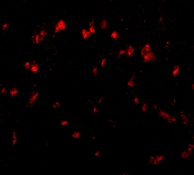 Immunofluorescence of Spred1 in Human Brain cells using ab77079 at 20 ug/ml.