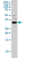 Anti-Sprouty 2 antibody (ab60719) at 1 µg/ml + C32 cell lysate at 25 µg