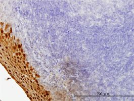SPRR3 antibody (ab58233) used in immunohistochemistry at 3ug/ml on formalin fixed and paraffin embedded human tonsil.