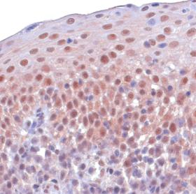 ab10546 was used in immunohistochemistry with paraffin embedded sections of human tonsil, using DAB as a chromogen (brown). Counterstaining of nuclei was performed with haemotoxylin (blue).Strong staining of epithelial cell nuclei is seen (and some staining of the cytoplasm) in this image.  