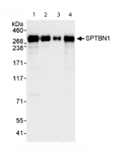 All lanes : Anti-SPTBN1 antibody (ab72239) at 0.04 µg/mlLane 1 : Whole cell lysate from Hela cells at 50 µgLane 2 : Whole cell lysate from Hela cells at 15 µgLane 3 : Whole cell lysate from Hela cells at 5 µgLane 4 : Whole cell lysate from 293T cells at 50 µg