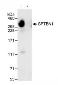 Immunoprecipitation/ Western Blot of SPTBN1. Lane 1: ab72239 at 3µg/mg whole cell lysate. Lane 2: Control IgG. ab72239 at 1µg/ml for WB. Whole cell lysate from Hela cells at 1mg for IP, 20% of IP loaded. Chemiluminescence with an exposure time of 1 second.