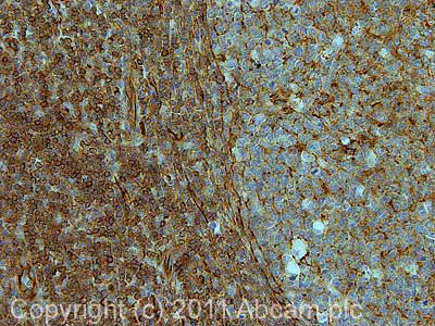 IHC image of ab72239 staining in human normal tonsil formalin fixed paraffin embedded tissue section, performed on a Leica BondTM system using the standard protocol F. The section was pre-treated using heat mediated antigen retrieval with sodium citrate buffer (pH6, epitope retrieval solution 1) for 20 mins. The section was then incubated with ab72239, 1µg/ml, for 15 mins at room temperature and detected using an HRP conjugated compact polymer system. DAB was used as the chromogen. The section was then counterstained with haematoxylin and mounted with DPX.For other IHC staining systems (automated and non-automated) customers should optimize variable parameters such as antigen retrieval conditions, primary antibody concentration and antibody incubation times.