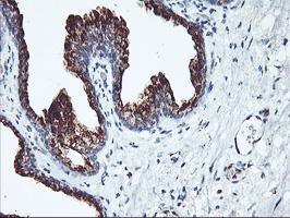 Immunohistochemical staining of SQSTM1 / p62, using ab119409 at 1/150, in paraffin-embedded Human prostate tissue.