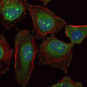 ab119912 at 1/200 dilution staining Skp1 in HeLa cells by Immunofluorescence (green). Blue: DRAQ5 fluorescent DNA dye. Red; Actin filaments have been labeled with Alexa Fluor-555 phalloidin.