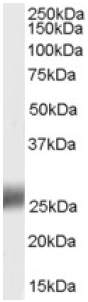 Anti-SRD5A2 antibody (ab27469) at 0.3 µg/ml + Human testes lysate (35ug protein in RIPA buffer)