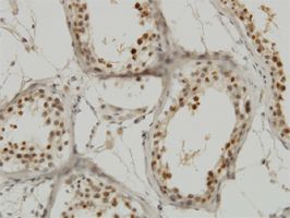 SRP1 antibody (ab55387) used in immunohistochemistry at 1ug/ml on formalin fixed and paraffin embedded human testis.