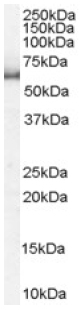 Anti-SRP1 antibody (ab6035) at 1 µg/ml + HeLa lysate (RIPA buffer, 35µg total protein per lane).