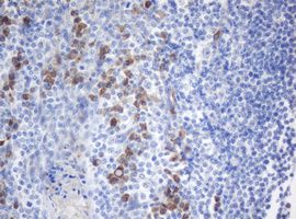 Immunohistochemical analysis of paraffin embedded Human tonsil tissue labeling SRPR beta with ab139279 antibody at a dilution of 1/500.