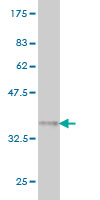 Western blot against tagged recombinant protein immunogen using ab56995 SSBP3 antibody at 1ug/ml.