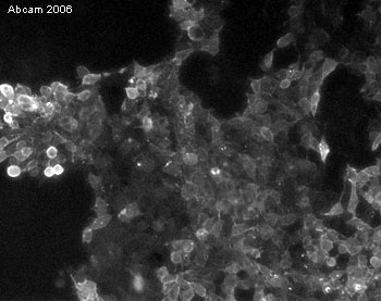 The image shows staining of the cell membranes of P19 mouse embryonic carcinoma cells using SSEA1-specific antibody, ab16285.