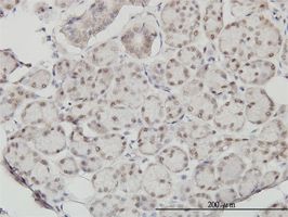 SSH3 antibody (ab57485) used in immunohistochemistry at 5ug/ml on formalin fixed and paraffin embedded human salivary gland.