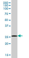 Anti-SSPN antibody (ab67584) at 1/500 dilution + human colon tissue lysate at 25 µgSecondaryGoat Anti-Mouse IgG (H&L)-HRP Conjugate at 1/2500 dilution