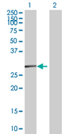 All lanes : Anti-SSPN antibody (ab67584) at 1/500 dilutionLane 1 : SSPN transfected 293T cell lysateLane 2 : Non-transfected 293T cell lysateLysates/proteins at 25 µg per lane.SecondaryGoat Anti-Mouse IgG (H&L)-HRP Conjugate at 1/2500 dilution