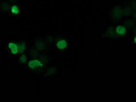 ab119036, at 1/100 dilution, staining SSX1 in COS7 cells transiently transfected with pCMV6-ENTRY SSX1 by Immunofluorescence.
