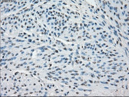 Immunohistochemical staining of paraffin embedded Human endometrium tissue, using ab117972 at a dilution of 1/50.