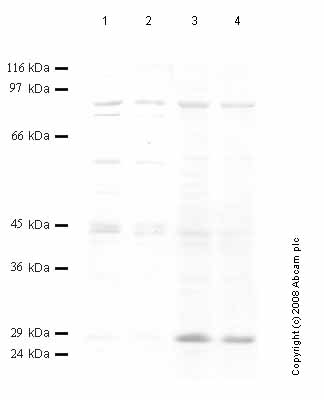 All lanes : Anti-ST14 antibody - Catalytic domain (ab59779) at 1/1000 dilutionLane 1 : Whole cell lysate from human prostate cancer DU145 cellsLane 2 : Whole cell lysate from human prostate cancer DU145 cellsLane 3 : Whole cell lysate prepared from human embryonic kidney HEK293 cellsLane 4 : Whole cell lysate prepared from human embryonic kidney HEK293 cells