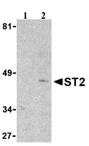 All lanes : Anti-ST2 antibody (ab25877) at 1 µg/mlLane 1 : Mouse kidney lysate in presence of blocking peptide (1ug/ml)Lane 2 : Mouse kidney lysate in absence of blocking peptide 