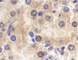ab25877 at 2µg/ml staining ST2 in mouse kidney tissue by IHC