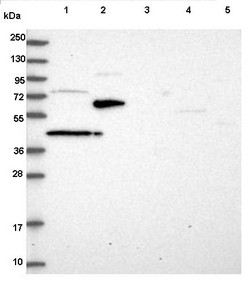 All lanes : Anti-ST7 antibody (ab122459) at 1/250 dilutionLane 1 : RT 4 cell line lysateLane 2 : U 251 MG cell line lysateLane 3 : Human plasmaLane 4 : Human liver tissue lysateLane 5 : Human tonsil tissue lysate