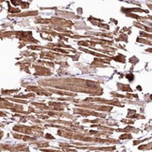 ab122459, at 1/500, staining ST7 in paraffin embedded Human heart muscle tissue by Immunohistochemistry.