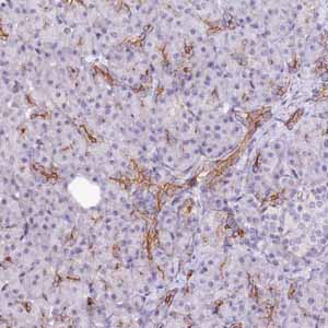 Immunohistochemical staining of Human pancreas shows moderate membranous positivity using ab122459