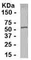 Anti-ST8SIA1 antibody (ab37806) at 1/2000 dilution + E. coli derived fusion protein at 2.5 µgSecondaryHRP conjugated Goat anti IgY at 1/1000 dilution