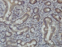 Immunohistochemical analysis of formalin-fixed, paraffin-embedded Human small intestine tissue, staining STAM1 with ab56346 at 3 µg/ml.