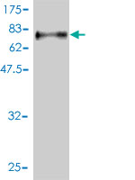 Western blot against tagged recombinant protein immunogen using ab56346 STAM1 antibody at 1ug/ml.