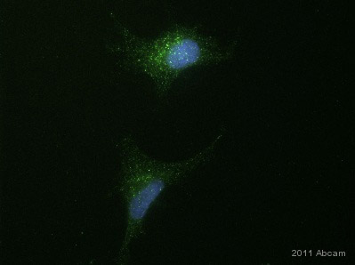 ab56346 staining STAM1 in Human retinal pigmented epithelial cells by Immunocytochemistry/ Immunofluorescence.Cells were fixed in paraformaldehyde, permeabilized using Triton X-100 and then incubated with ab56346 at a 1/100 dilution at 25°C. The secondary used was an Alexa-Fluor 488 conjugated donkey polyclonal used at a 1/500 dilution.See Abreview