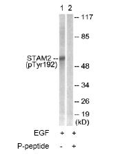 All lanes : Anti-STAM2 (phospho Y192) antibody (ab63569) at 1/500 dilutionLane 1 : Extracts from NIH/3T3 cells (5-30µg), treated with EGF (200ng/ml, 30mins), minus immunising peptide.Lane 2 : Extracts from NIH/3T3 cells (5-30µg), treated with EGF (200ng/ml, 30mins), plus immunising peptide (5-10µg).