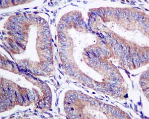 Immunohistochemical analysis of paraffin-embedded Human uterus tissue labeling STAM2 with ab151545 at 1/50 dilution.