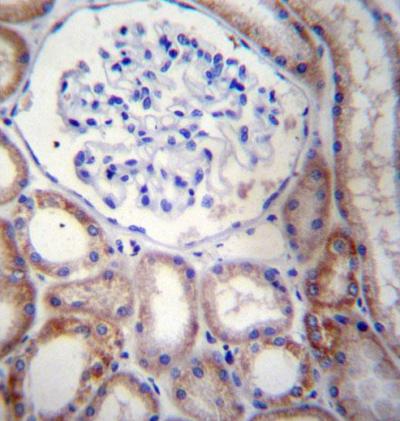 Immunohistochemical analysis of formalin-fixed paraffin-embedded Human kidney tissue, labeling STARD5 with ab171192 at 1/10 dilution, followed by peroxidase conjugation of the secondary antibody and DAB staining.
