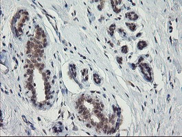 Immunohistochemical analysis of paraffin embedded Human breast tissue labelling SLAP2 with ab131571 antibody at a dilution of 1/150.