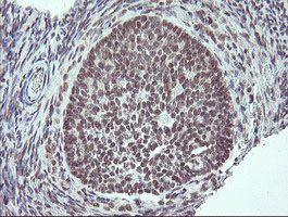 Immunohistochemical analysis of paraffin embedded Human ovary tissue labelling SLAP2 with ab131571 antibody at a dilution of 1/150.