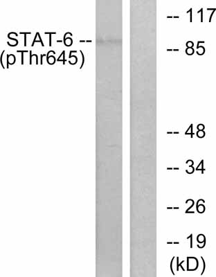 All lanes : Anti-STAT6 (phospho T645) antibody (ab30650)Lane 1 : Hela cells. Antibody un-treated.Lane 2 : Hela cells. Antibody pre-incubated with synthetic phosphopeptide.