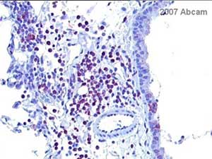 ab28829 at 1/100 staining mouse lung tissue sections by IHC-P. The tissue was formaldehyde fixed and blocked with serum. A heat mediated antigen retrieval step was performed prior to incubation with the antibody. Ab6720 (Goat polyclonal to Rabbit IgG H&L (biotin)) was used as the secondary antibody.See Abreview
