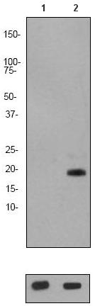 All lanes : Anti-Stathmin 1 (phospho S24) antibody [EP2124Y] (ab62336) at 1/1000 dilutionLane 1 : HeLa cell lysate (untreated)Lane 2 : HeLa cell lysate (treated with FBS+Calyculin A)Lysates/proteins at 10 µg per lane.SecondaryGoat anti-rabbit HRP conjugate at 1/2000 dilution