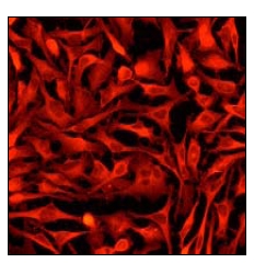 Immunofluorescent staining of Stathmin 1 in HeLa cells using ab52906 at 1/100 dilution.