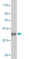 Western blot against tagged recombinant protein immunogen using ab57828 Staufen antibody at 1ug/ml.