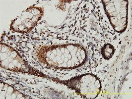 Stefin B antibody (ab54566) used in immunohistochemistry at 5ug/ml on formalin fixed and paraffin embedded human colon tissue.