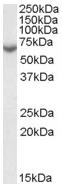 Anti-Steroid sulfatase antibody (ab65094) at 0.01 µg/ml + Human Placenta lysate (35µg protein in RIPA buffer).