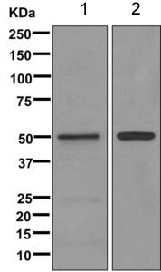All lanes : Anti-Steroidogenic Factor 1 antibody [EPR11695(B)] (ab168380) at 1/1000 dilutionLane 1 : Jutkat cell lysateLane 2 : HepG2 cell lysateLysates/proteins at 10 µg per lane.SecondaryGoat anti-rabbit HRP at 1/2000 dilution