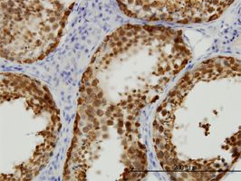 STIP1 antibody (ab56873) used in immunohistochemistry at 5ug/ml on formalin fixed and paraffin embedded human testis.