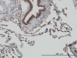STIP1 antibody (ab56874) used in immunohistochemistry at 3ug/ml on formalin fixed and paraffin embedded human lung.