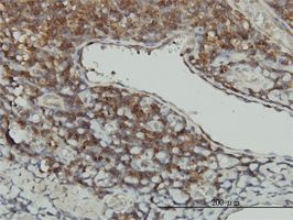 STK16 antibody (ab56447) used in immunohistochemistry at 3ug/ml on formalin fixed and paraffin embedded human tonsil.