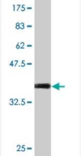 Anti-STK31 antibody (ab76839) at 5 µg/ml + immunogen at 0.2 µgSecondaryGoat Anti-Mouse IgG (H&L)-HRP Conjugate at 1/5000 dilution